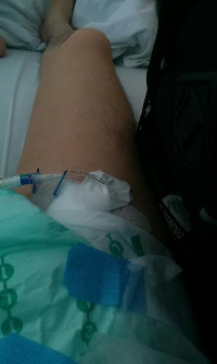 40代,前半,心筋梗塞,体験,ピエール