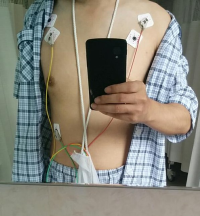 40代,前半,心筋梗塞,体験,ピエール